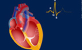 ANIMACIONES FLASH PARA PORTAL MÉDICO MEDIFUSIÓN